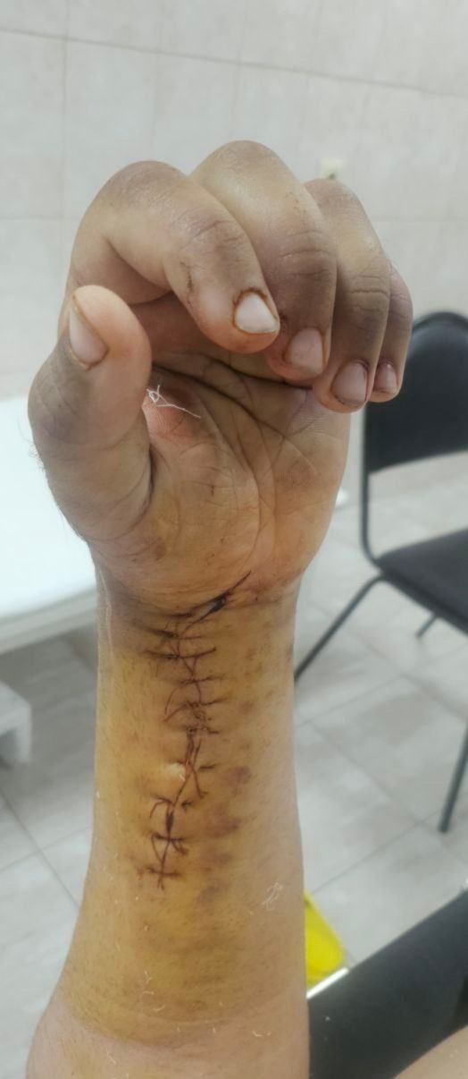 ДТП подписчика