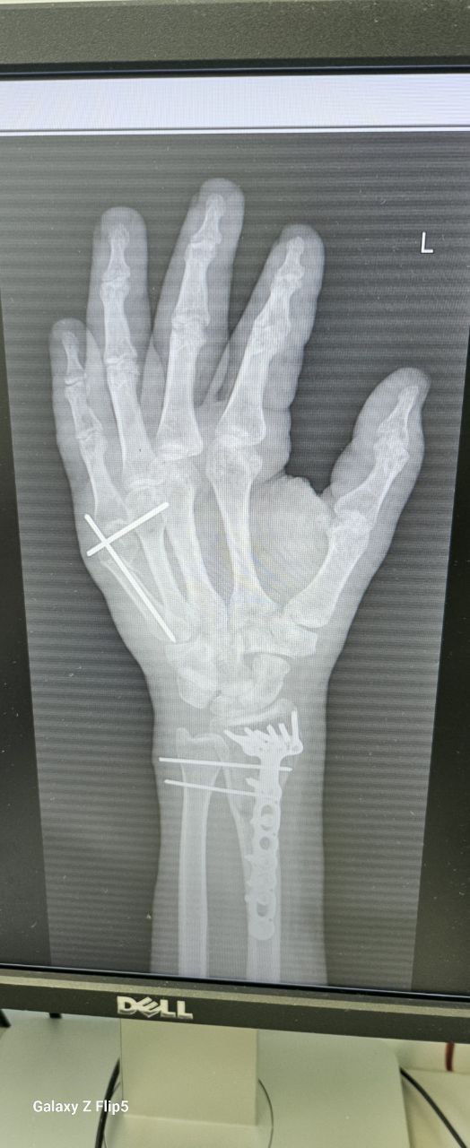 ДТП подписчика